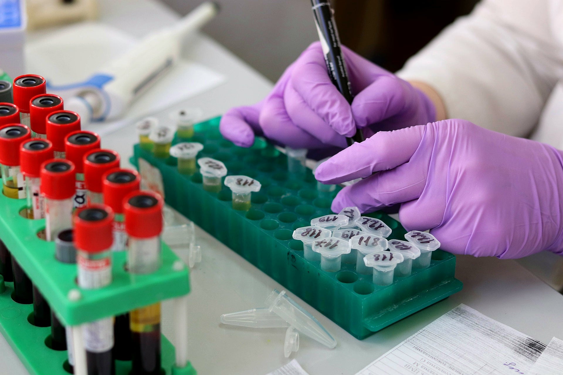 Bluekites healthcare services-Healthcare Lab test service visit home Package-6